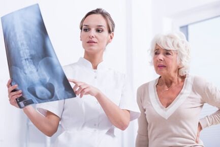 O médico mostra ao paciente unha imaxe x -ray da columna vertebral