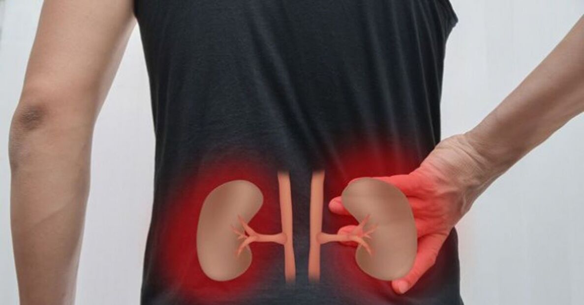 A enfermidade renal como causa da dor lumbar