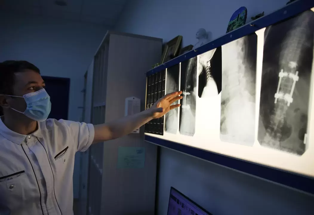 Os médicos diagnostican a osteocondrose cervical mediante métodos instrumentais como a radiografía
